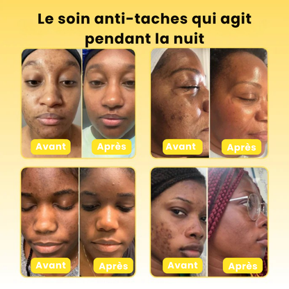 Masque de Nuit – Efface les Taches Brunes & Unifie le Teint